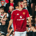 Amorim Cemas, Namun Optimis: Cedera De Ligt Bukan Masalah Serius