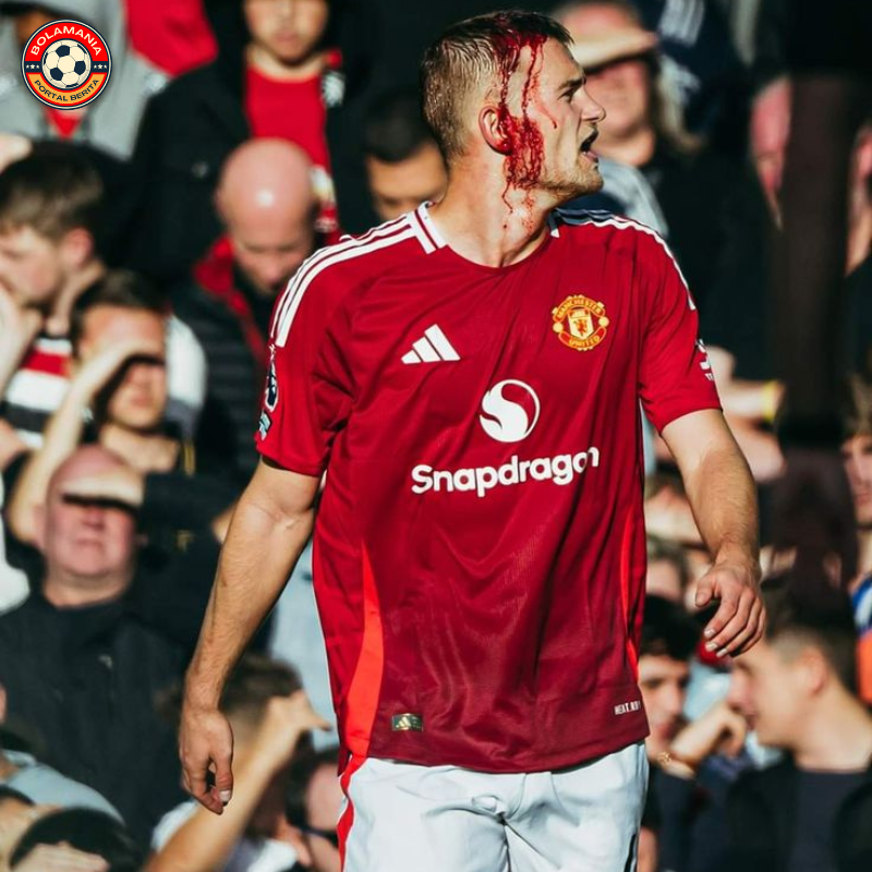 Amorim Cemas, Namun Optimis: Cedera De Ligt Bukan Masalah Serius